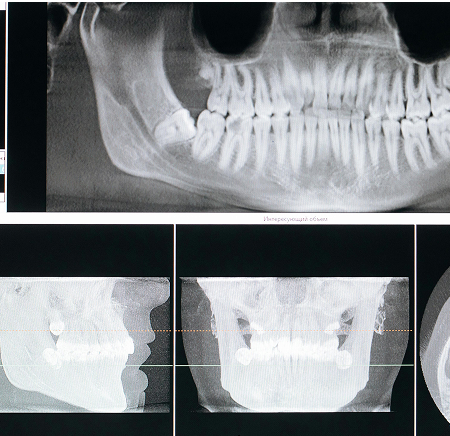 Cutting-Edge Sensors
